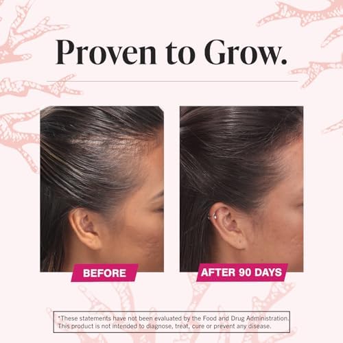 Viviscal Hair Growth Supplements for Women, Dietary Hair Supplement Tablets With AminoMar Collagen Complex, Biotin, Zinc, Vitamin C, and Iron, Nourish Thinning Hair, 30 Day Supply, 60 Count