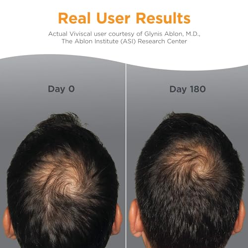 Viviscal Men's Hair Growth Supplements for Thicker, Fuller Hair Clinically Proven with Proprietary Collagen Complex 180 Tablets - 3 Month Supply