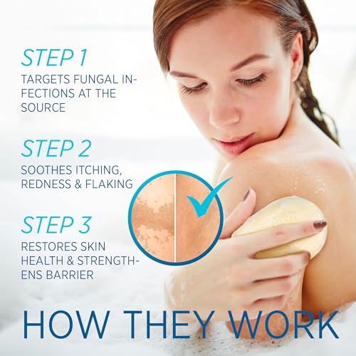 Tinea Versicolor Relief Cream & Soap: Clinically Proven Treatment for Tinea Versicolor, Athlete’s Foot, Ringworm, and Fungal Skin Conditions – Soothes, Cleanses, and Restores Skin Health