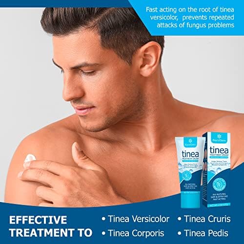 Roycederm Tinea Versicolor Treatment, Athletes Foot Treatment, Ringworm Treatment for Humans, for Tinea Versicolor & Pedis,Fast Healing Anti Fungal Skin Cream - Multi-Functional