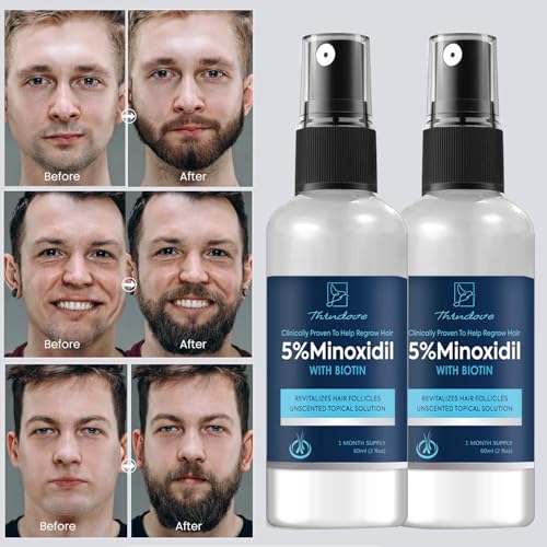 Minoxidil Beard Growth Oil, 5% Minoxidil Hair Growth Kit, 5% Minoxidil for Men Beard Growth Spray Infused with Bitoin, Extra Strength Beard Growth Serum to Increase Thickness and Volume Faster