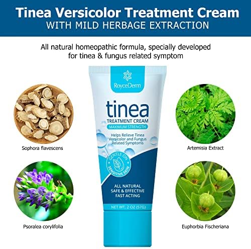 Roycederm Tinea Versicolor Treatment, Athletes Foot Treatment, Ringworm Treatment for Humans, for Tinea Versicolor & Pedis,Fast Healing Anti Fungal Skin Cream - Multi-Functional