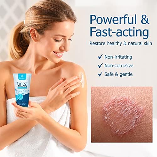 Roycederm Tinea Versicolor Treatment, Athletes Foot Treatment, Ringworm Treatment for Humans, for Tinea Versicolor & Pedis,Fast Healing Anti Fungal Skin Cream - Multi-Functional