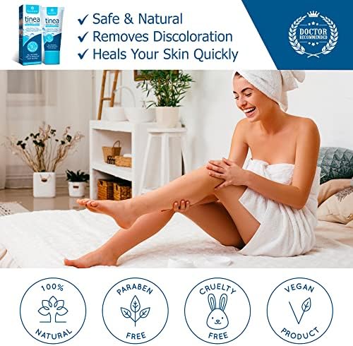 Roycederm Tinea Versicolor Treatment, Athletes Foot Treatment, Ringworm Treatment for Humans, for Tinea Versicolor & Pedis,Fast Healing Anti Fungal Skin Cream - Multi-Functional