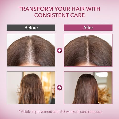 Onion & Rosemary Hair Growth Shampoo: Biotin Infused Shampoo for Hair Loss and Thinning Hair - Promotes Healthier, Thicker and Stronger Hair for Women and Men - 16.9 oz