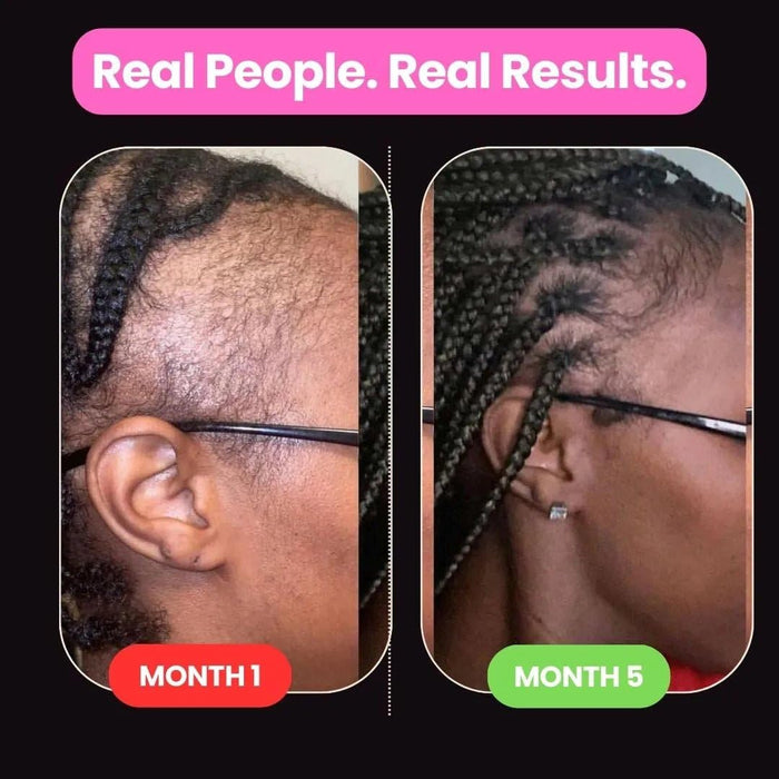 Hair Growth CO Formulated With African Chebe Powder For Extreme Hair Growth, 2 Fl Oz (2-Pack) , 2.0 ounces