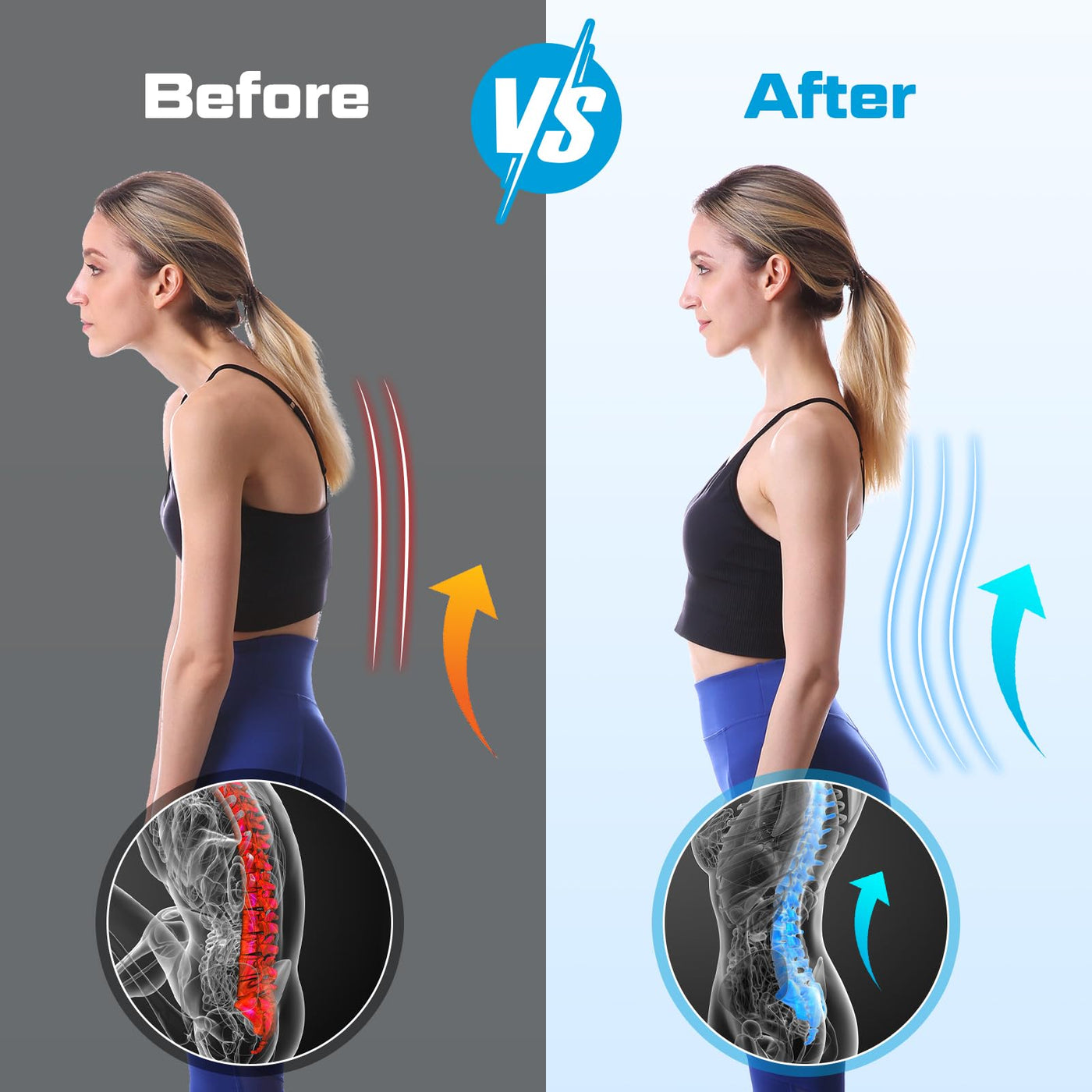 NEENCA Professional Back Brace for Herniated Disc, Lower Back Pain Rel ...