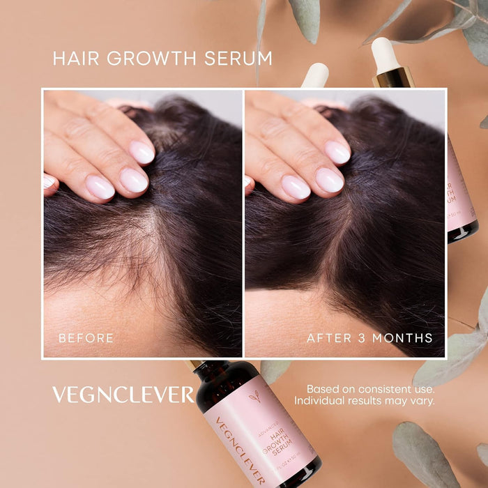Hair Growth Serum for Women, Veganic Natural Hair Growth Oil - 100% Vegan Hair Regrowth Serum, Gro Hair Serum for Hair Loss, Hair Thickening Products for Women, 50ML