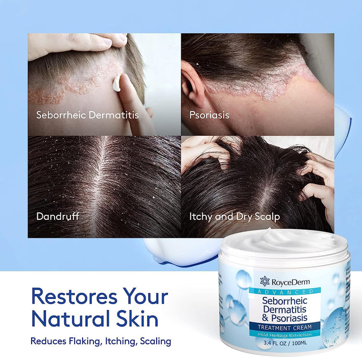 Roycederm Seborrheic Dermatitis & Psoriasis Cream – Scalp Treatment for Itch Relief, Dry Scalp, Folliculitis, and Dandruff (3.4 oz)